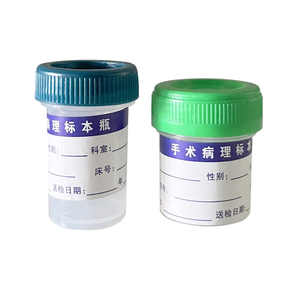 Factory Direct Sales Plastic Sample Specimen Container Bottle Used for Collecting Urine
